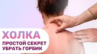 Остеохондрозная холка на шее. Немеют руки.