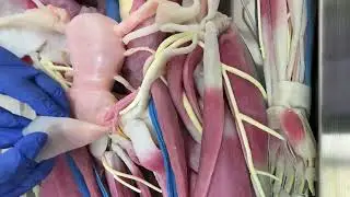 Synthetic Cadaver - Female Reproductive System