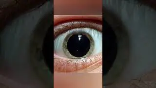 Evaluation of Pupil