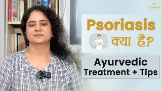 Psoriasis Ayurvedic Treatment | Best Tips for Psoriasis | Home Remedies for Psoriasis