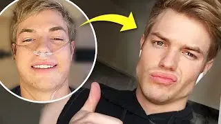 I Built a Model Jawline with Average Genetics