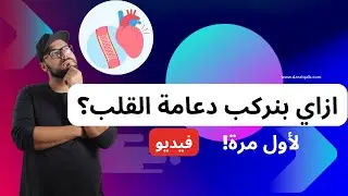 كيف يتم تركيب دعامة الشريان التاجي؟ لأول مرة بالفيديو!