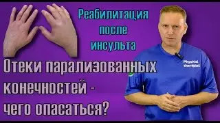 Отеки парализованных конечностей - в чем опасность, как бороться.