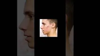 photo retouching with Snapseed | how to remove pimples from face with Snapseed application