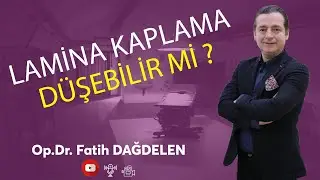 Lamina Kaplamalar  Düşebilir Mi ?