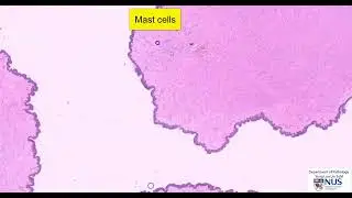Skin: Neurofibroma Microscopy (Talking slide)