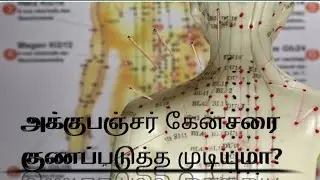 WILL ACUPUNCTURE CURE CANCER?  IN TAMIL