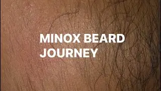 MONTH 10: Beard Journey | A 10 month beard gains