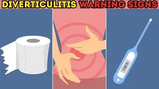 Warning Signs of Diverticulitis | Diverticulitis Symptoms and Signs | Diverticulitis Signs