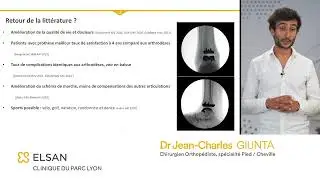 Prothèse de cheville sur mesure - Dr Jean Charles GIUNTA, chirurgien orthopédiste