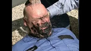Cooling Asphalt Burns (edited)
