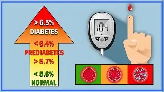 💊 ¿Sabes si Tienes Diabetes? Conoce Síntomas, Tipos, Causas y Tratamientos | SALUDABLEMENTE TV