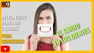Como QUITAR el SARRO de los DIENTES | Elimina el SARRO con REMEDIOS CASEROS
