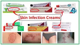 दाद खाज खुजली की सबसे अच्छी क्रीम ll Clobeta gm cream ll Betnovate cream ll Quadiderm ll