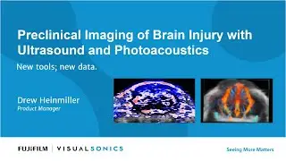 Preclinical Imaging of Brain Injury with Ultrasound and Photoacoustics - New tools; new data