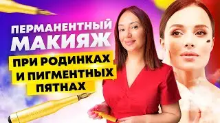 Перманентный макияж при родинках и пигментных пятнах
