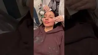 Microneedling With PRP | GOODSKIN