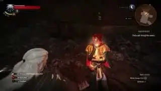 I guess Triss is ... hot?