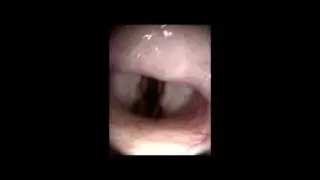 laryngoscopy