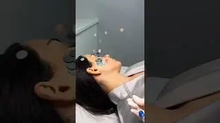 JetPeel - это поистине волшебный ритуал, который способен преобразить вашу кожу🤩 #shorts