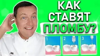 Как делают пломбу на зуб? Все этапы ПРОСТЫМИ словами. Подробное описание установки пломбы на зуб.