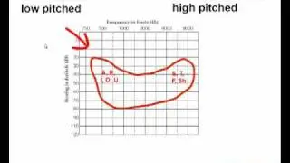 How to Read an Audiogram - Watch this Video Before You Buy Hearing Aids!