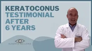 Keratoconus treatment: Patient Testimonial After 6 Years