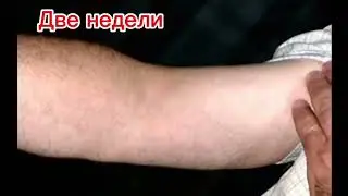 LUGELA!