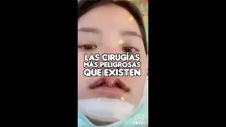 LAS CIRUGÍAS MÁS PELIGROSAS QUE EXISTEN EN EL MUNDO 