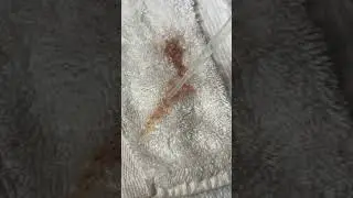 Removing blood from a towel