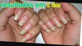 COMO FAZER A UNHA CRESCER EM 2 DIAS