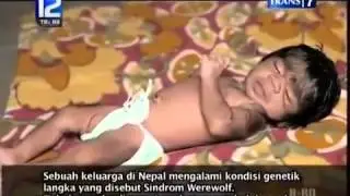 On The Spot  Trans 7    Fakta Keluarga Unik
