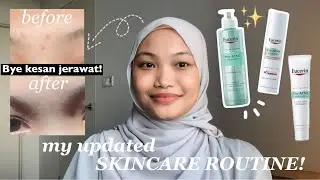 Updated Skincare Routine Untuk Jerawat & Kesan Jerawat With Eucerin ProACNE Solution! 🧴🫧