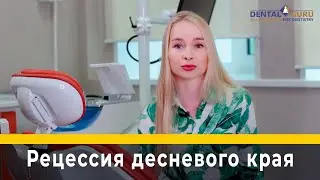 Рецессия десневого края. Пластика десны