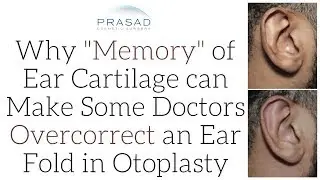 Why Overcorrection to the Ear Fold is Sometimes Done to Prevent Regression of Ear Shape