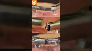 Easily repair dental appliances that don't fit right with a laser welder by Sunstone!