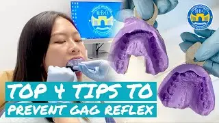 Getting Dental Impression - How to Prevent From Gagging