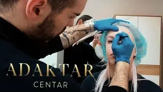 TETOVIRAM SE NA LICU!