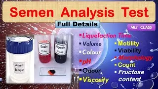 SEMEN ANALYSIS TEST Full Details 🔬💥 SPERM MOTILITY 💥 SPERM COUNT 🔬@MLTclass 🩸#dmlt #bmlt #sperm