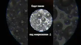 Сода+лимон под микроскопом 😍#биология #biology #micro #microscope #science #scienceexperiment
