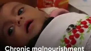Food shortages caused by #COVID-19 lockdown threaten vulnerable children in #Afghanistan