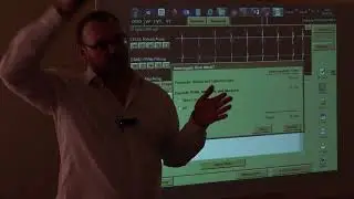 Принципы работы ИКД