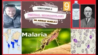 9- General microbiology| Giemsa stain| Preparation| malaria detection and other parasites