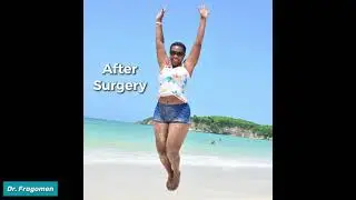 Sandra's Knock Knees