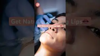 Lip Filler Procedure | Lip Filler Treatment #youtubeshorts #lipfiller #sbaesthetics #drshilpibhadani