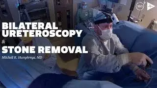 Bilateral Ureteroscopy and Kidney Stone Removal | Case Trailer