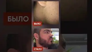 БУСТ ДЛЯ РОСТА БОРОДЫ