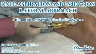 Knee Aspiration and Injection - Lateral Approach - In Vivo Series