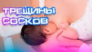 CRACKED NIPPLES: WE REVEAL THE CAUSES, TREATMENT AND PREVENTION SECRETS!