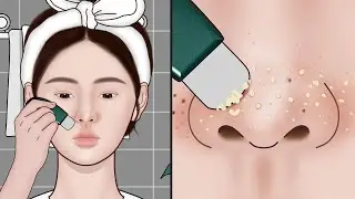 How to Remove Blackheads at Home? ASMR Blackhead Removal Animation | Meng's Stop Motion